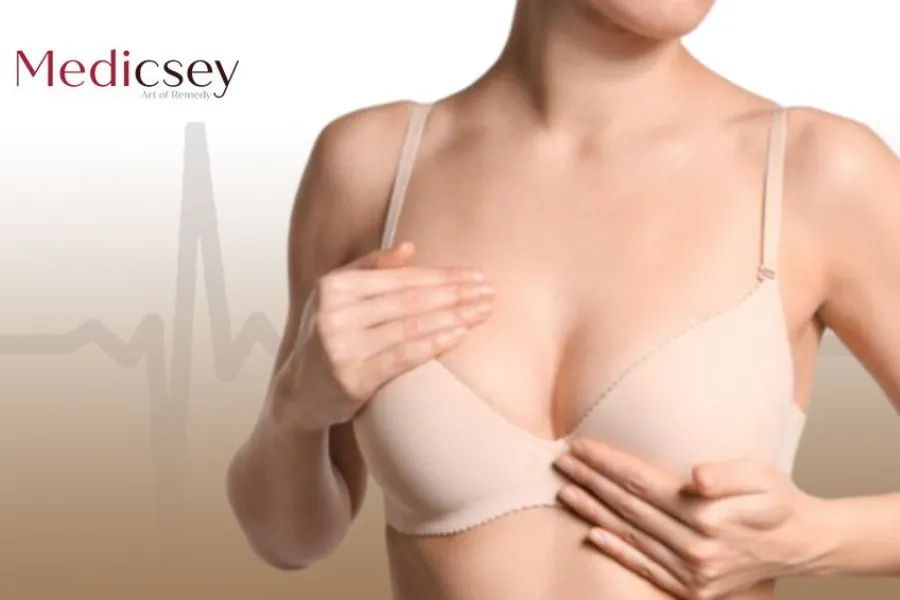 Breast Lift Price in Turkey Exploring the Cost in 2024